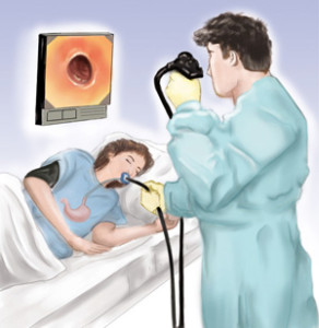 endoscopia